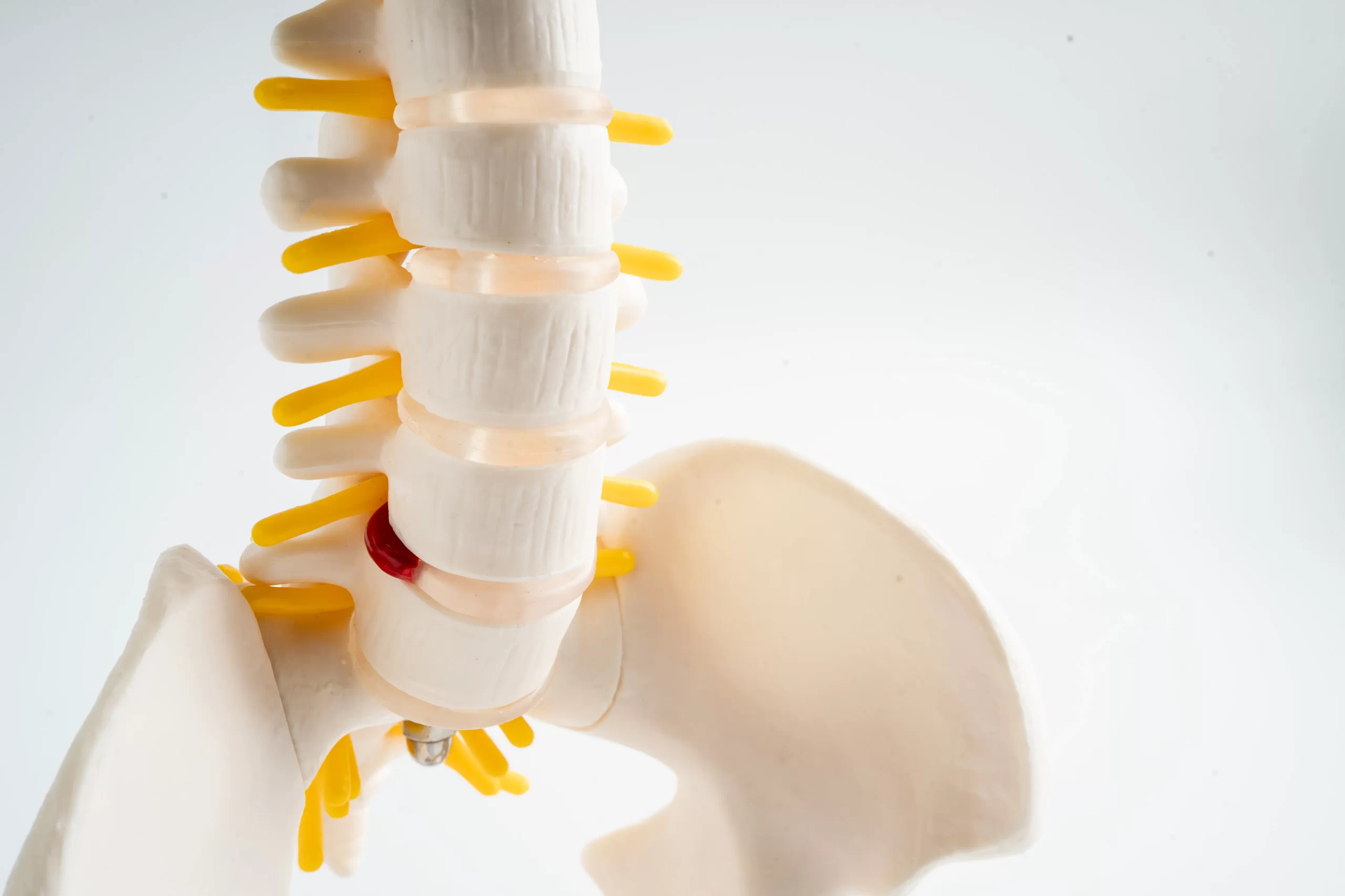 北九州市小倉 坐骨神経痛 専門施術